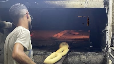 Nasser Suneina's years of baking Jerusalem kaek the traditional way has left him with burn scars and respiratory issues