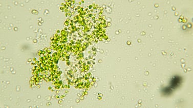 Abu Dhabi researchers believe green algae could help further cancer research. Photo: Sinhyu